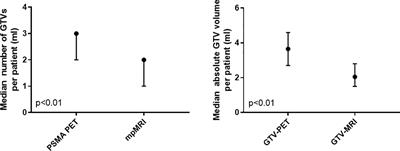 Intraindividual Comparison Between [18F] PSMA-1007 PET/CT and Multiparametric MRI for Radiotherapy Planning in Primary Prostate Cancer Patients